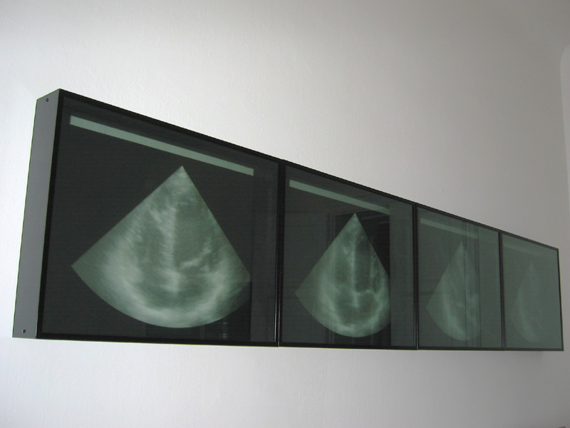 Wandinstallation/Teilansicht