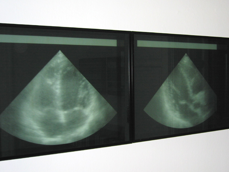 Human Interface-Teilansicht